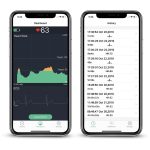 Viatom Visual Beat 24-órás pulzusmérő EKG funkcióval ER1-V