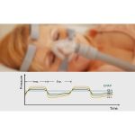 iBreeze 20A Resvent Auto CPAP / APAP légzéssegítő berendezés IBREEZE-20A